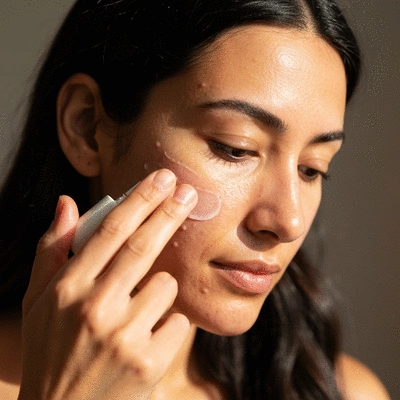 Close-up on a woman gently applying a chemical exfoliant serum to her dry, acne-prone face, soft lighting, focus on a healthy skin barrier