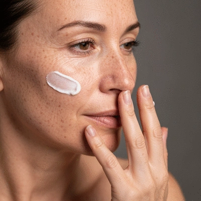 Person applying moisturizer to dry, acne-prone skin